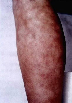 皮肤科医师之家